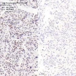 Anti-Phospho-JAK2(Y1007+Y1008) Rabbit pAb