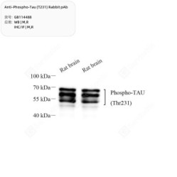 Anti-Phospho-Tau (T231) Rabbit pAb