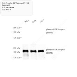 Anti-Phospho-EGF Receptor (Y1172) Rabbit pAb