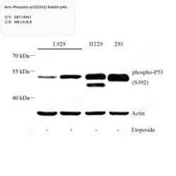 Anti-Phospho-p53(S392) Rabbit pAb