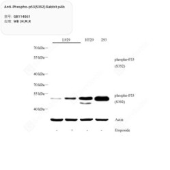 Anti-Phospho-p53(S392) Rabbit pAb