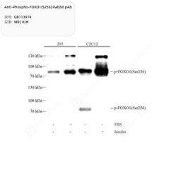Anti-Phospho-FOXO1(S256) Rabbit pAb