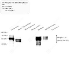 Anti-Phospho-TAU...