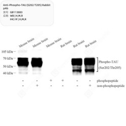 Anti-Phospho-TAU (S202/T205) Rabbit pAb