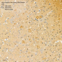 Anti-Phospho-TAU (S202/T205) Rabbit pAb