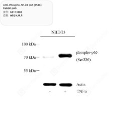 Anti-Phospho-NF-kB p65 (S536) Rabbit pAb