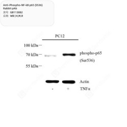 Anti-Phospho-NF-kB p65 (S536) Rabbit pAb