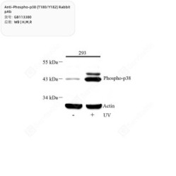 Anti-Phospho-p38 (T180/Y182) Rabbit pAb