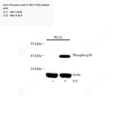 Anti-Phospho-p38 (T180/Y182) Rabbit pAb
