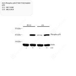 Anti-Phospho-p38 (T180/Y182) Rabbit pAb