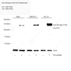 Anti-Phospho-FAK (Y397)...