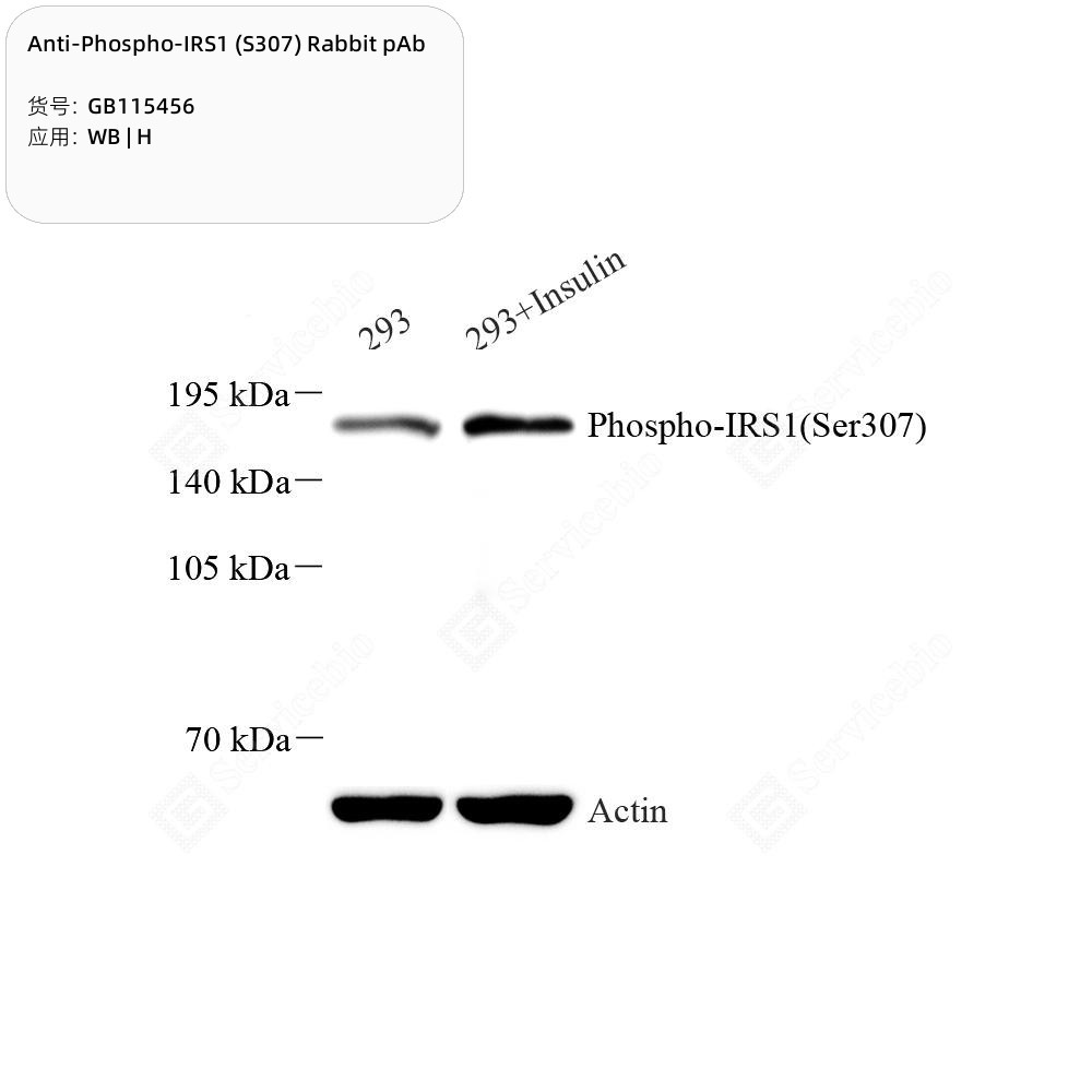 Anti-Phospho-IRS1 (S307) Rabbit pAb