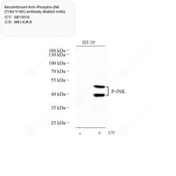 Recombinant Anti-Phospho-JNK (T183/Y185) antibody (Rabbit mAb)