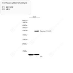 Anti-Phospho-p53 (S15)...