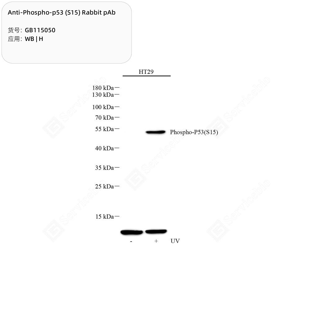 Anti-Phospho-p53 (S15) Rabbit pAb