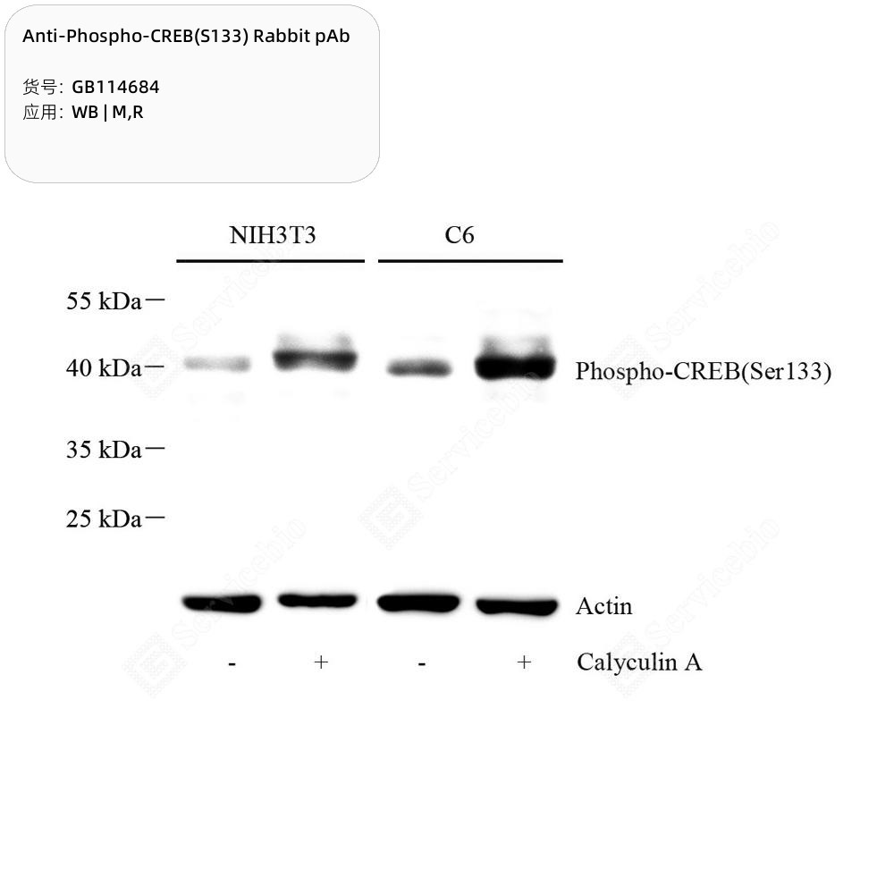 Anti-Phospho-CREB(S133) Rabbit pAb
