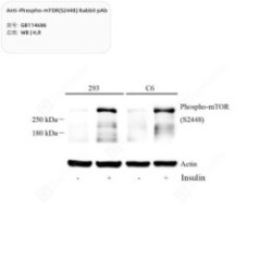 Anti-Phospho-mTOR(S2448)...