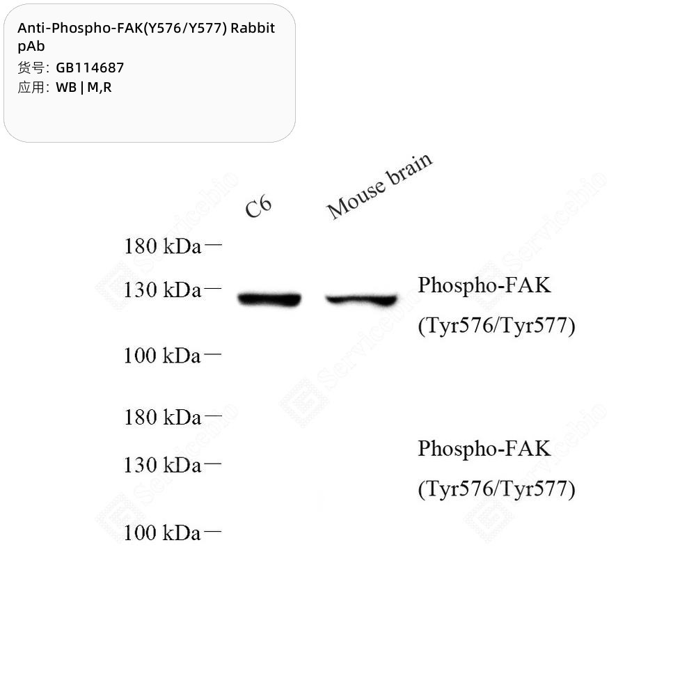 Anti-Phospho-FAK(Y576/Y577) Rabbit pAb