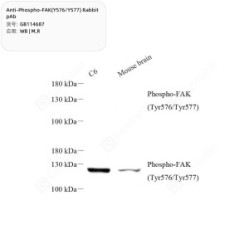 Anti-Phospho-FAK(Y576/Y577) Rabbit pAb