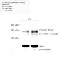 Anti-Phospho-JAK2(Y1007+Y10...