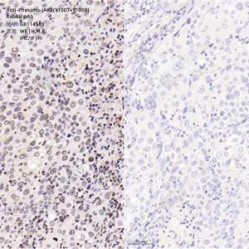 Anti-Phospho-JAK2(Y1007+Y1008) Rabbit pAb