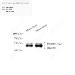 Anti-Phospho-Tau (T231)...
