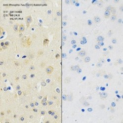 Anti-Phospho-Tau (T231) Rabbit pAb