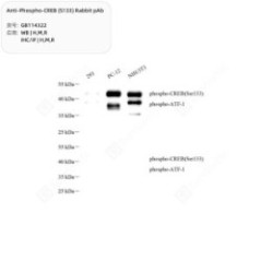Anti-Phospho-CREB (S133)...