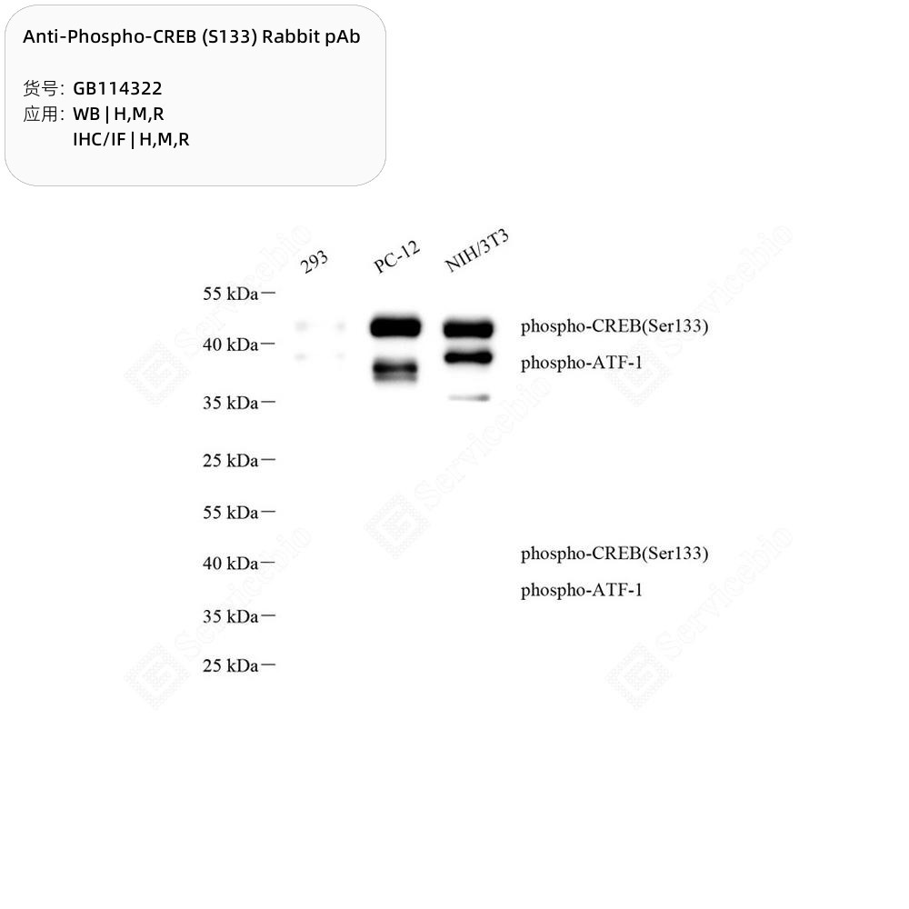 Anti-Phospho-CREB (S133) Rabbit pAb