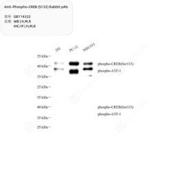 Anti-Phospho-CREB (S133) Rabbit pAb