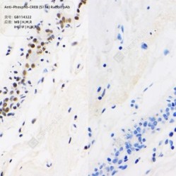 Anti-Phospho-CREB (S133) Rabbit pAb