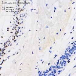Anti-Phospho-CREB (S133) Rabbit pAb