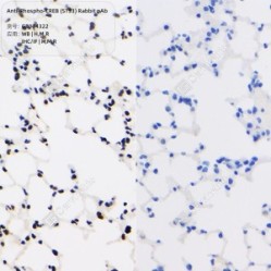 Anti-Phospho-CREB (S133) Rabbit pAb