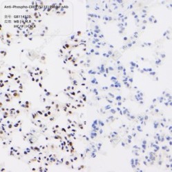 Anti-Phospho-CREB (S133) Rabbit pAb