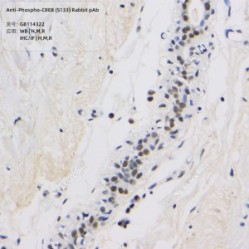 Anti-Phospho-CREB (S133) Rabbit pAb