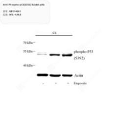 Anti-Phospho-p53(S392)...