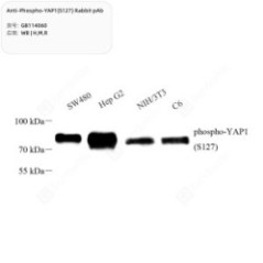 Anti-Phospho-YAP1(S127)...