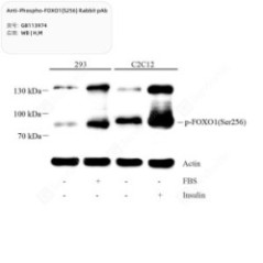Anti-Phospho-FOXO1(S256)...