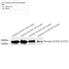 Anti-Phospho-EGFR (S1070)...