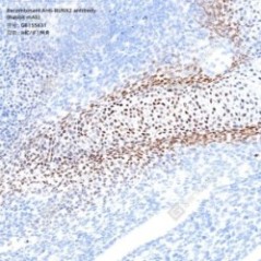 Recombinant Anti-RUNX2...
