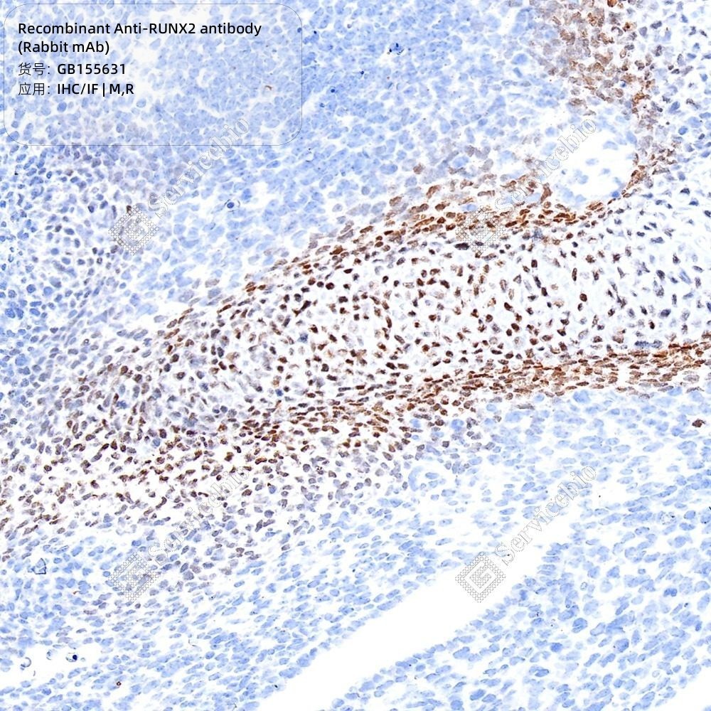 Recombinant Anti-RUNX2 antibody (Rabbit mAb) - 50 µL