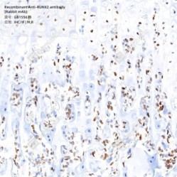 Recombinant Anti-RUNX2 antibody (Rabbit mAb) - 50 µL