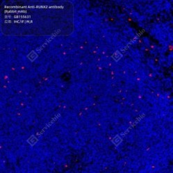 Recombinant Anti-RUNX2 antibody (Rabbit mAb) - 50 µL