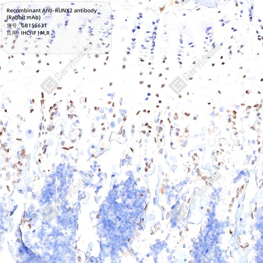 Recombinant Anti-RUNX2 antibody (Rabbit mAb) - 100 µL