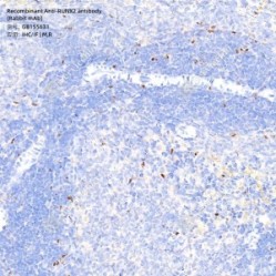 Recombinant Anti-RUNX2 antibody (Rabbit mAb) - 100 µL