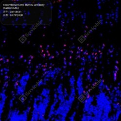 Recombinant Anti-RUNX2 antibody (Rabbit mAb) - 100 µL