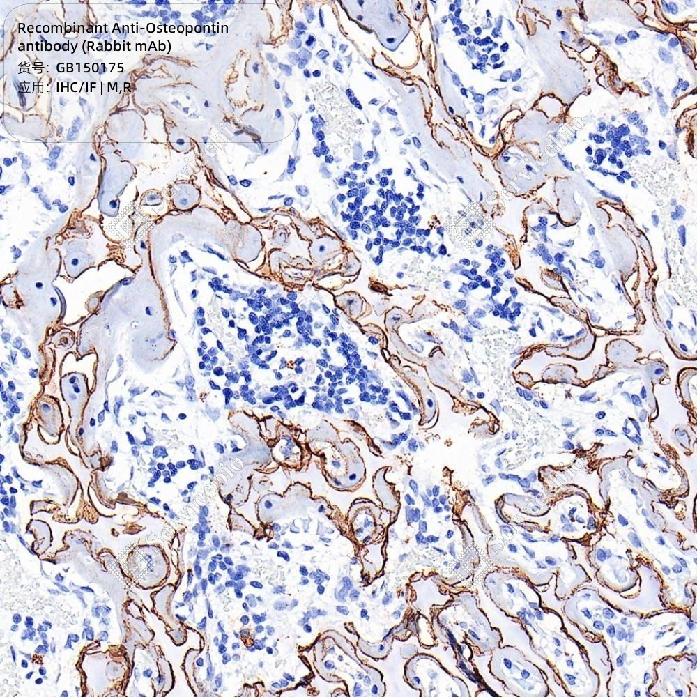 Recombinant Anti-Osteopontin antibody (Rabbit mAb) - 100 µL