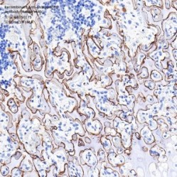 Recombinant Anti-Osteopontin antibody (Rabbit mAb) - 100 µL