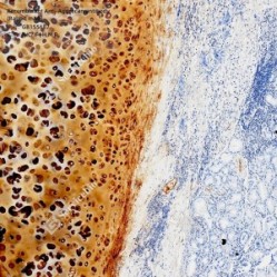 Recombinant Anti-Aggrecan antibody (Rabbit mAb) - 50 µL