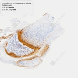 Recombinant Anti-Aggrecan antibody (Rabbit mAb) - 50 µL